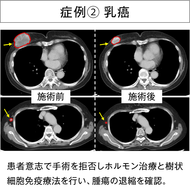 治療例2