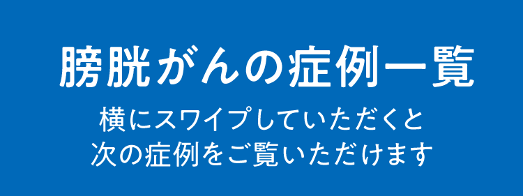 膀胱がんの症例一覧