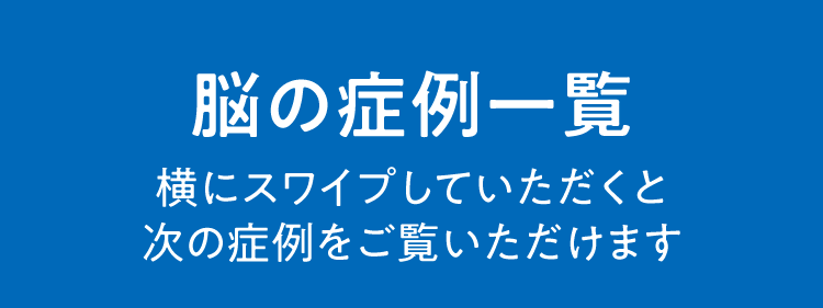 脳の症例一覧