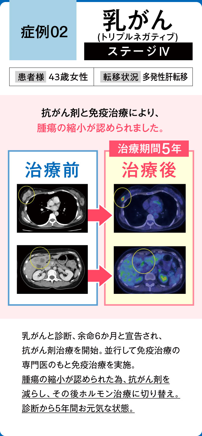 乳がん症例2
