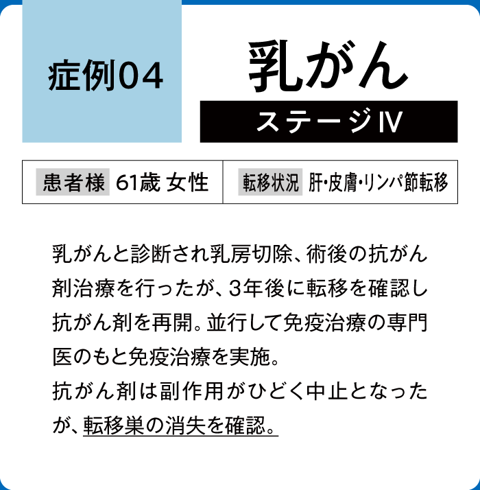 乳がん症例4