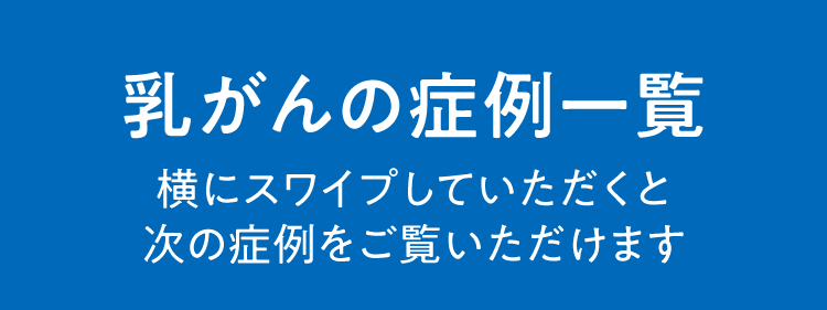 乳がんの症例一覧
