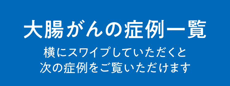 大腸がんの症例一覧