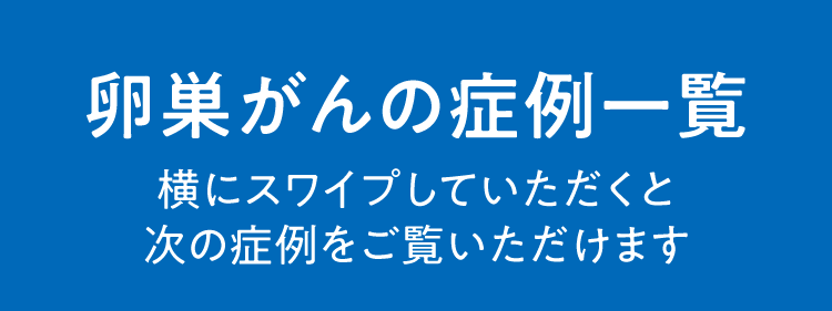 卵巣がんの症例一覧
