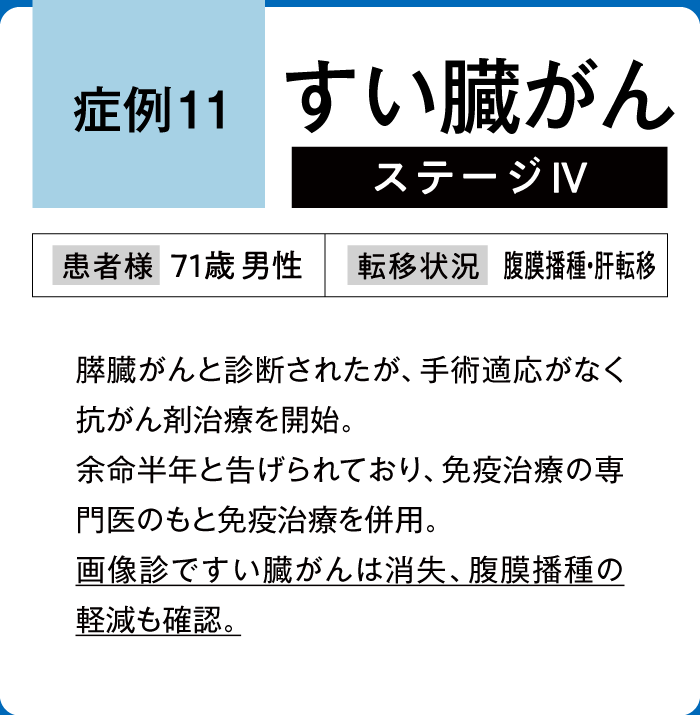 すい臓がん症例11