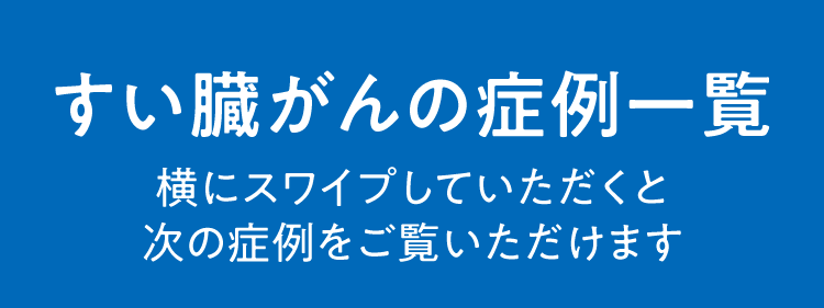 すい臓がんの症例一覧