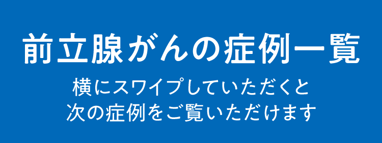 前立腺がんの症例一覧
