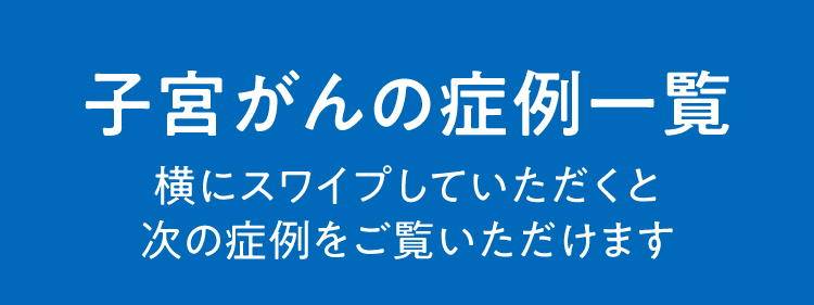 子宮がんの症例一覧