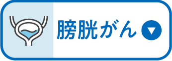 膀胱がん