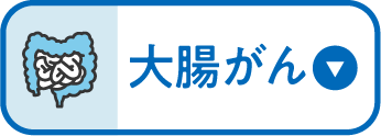 大腸がん