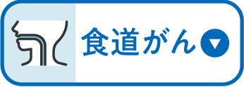 食道がん