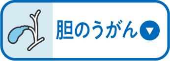 胆のうがん