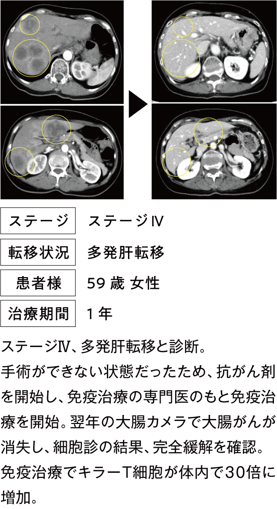 治療例1