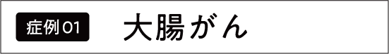 大腸がん