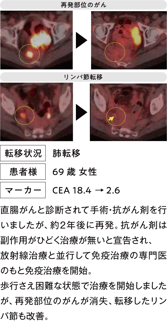 治療例2
