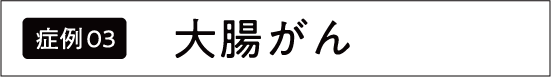 大腸がん