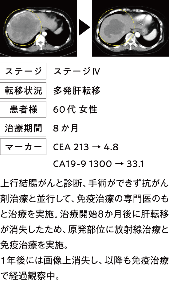 治療例4