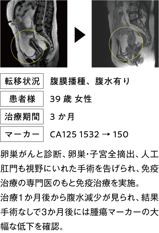 治療例1