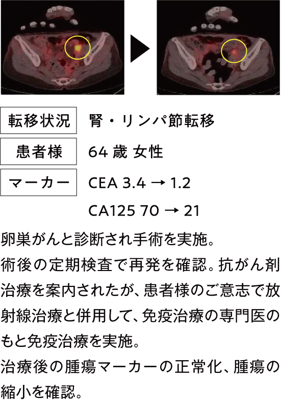 治療例2