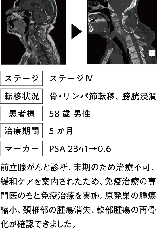 治療例1