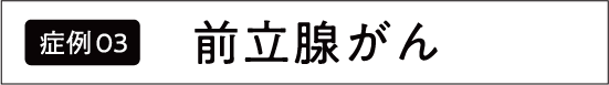 前立腺がん