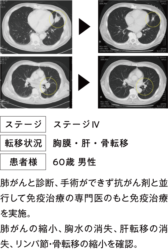 治療例1