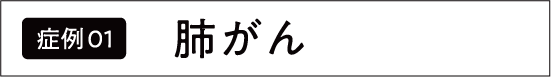 肺がん