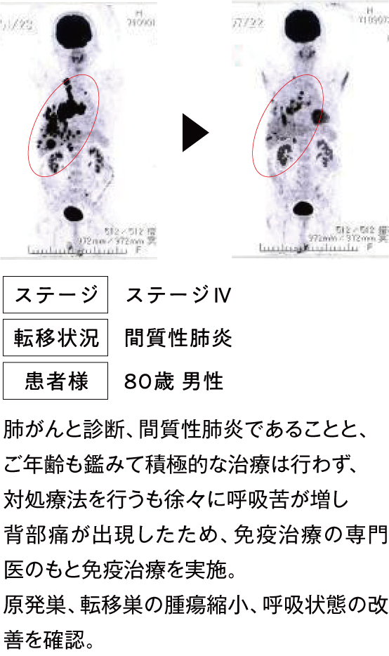治療例2