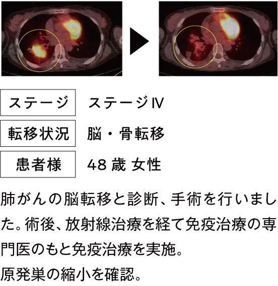 治療例3