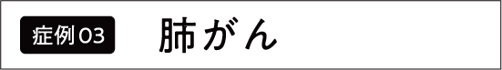 肺がん