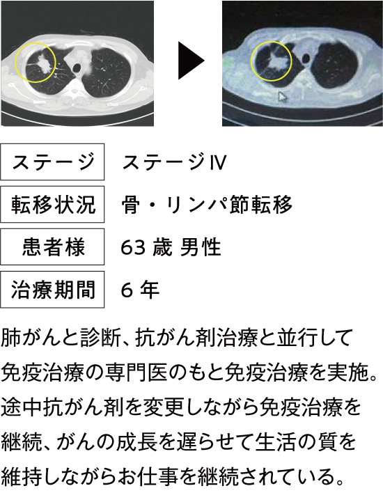治療例4