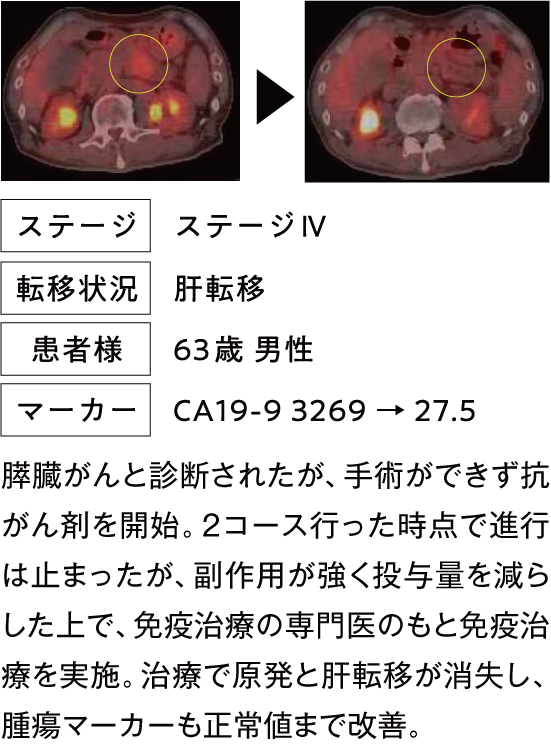 その後1年強は再発せず経過観察を継続中。
