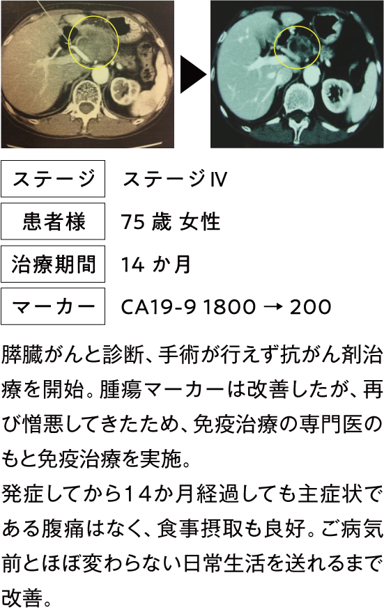 治療例