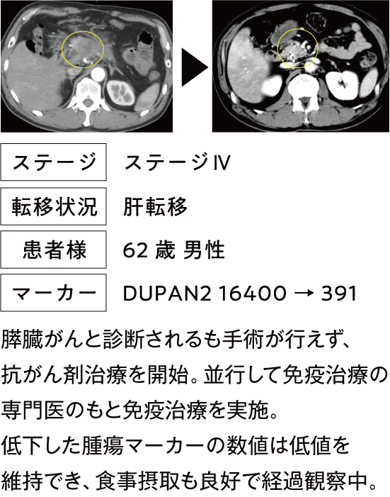治療例