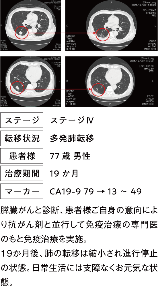 治療例
