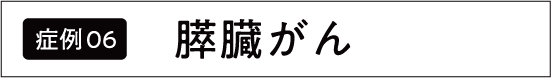 すい臓がん