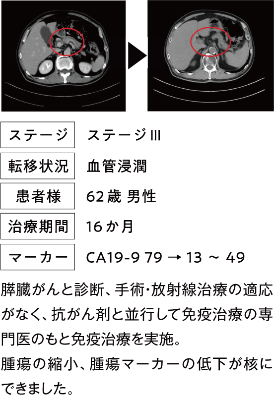 治療例