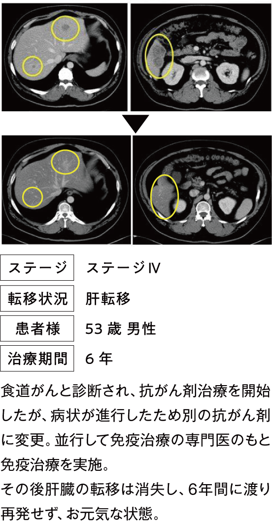 治療例1