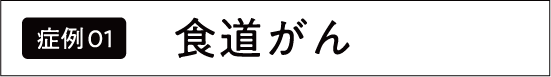 食道がん