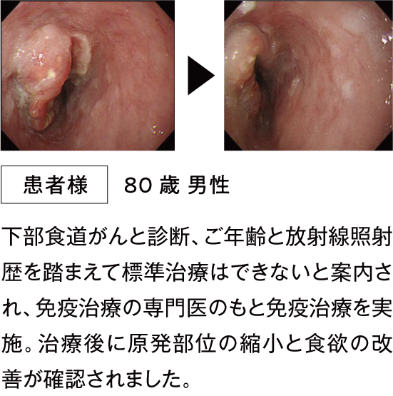 治療例2