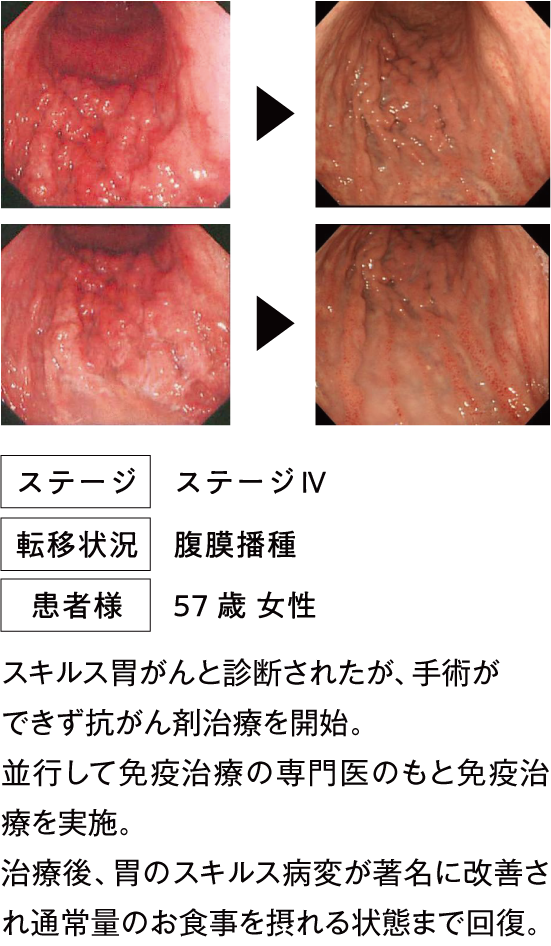 治療例1