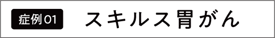 胃がん