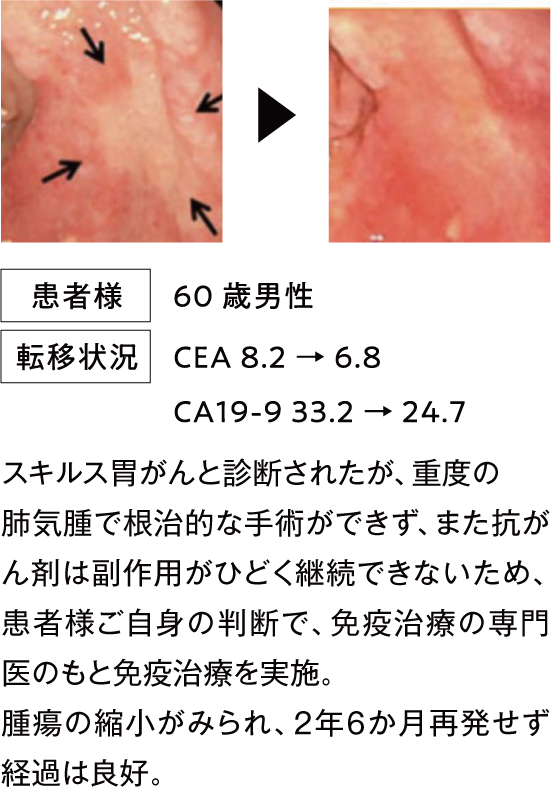 治療例1