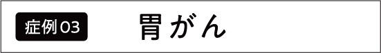 胃がん