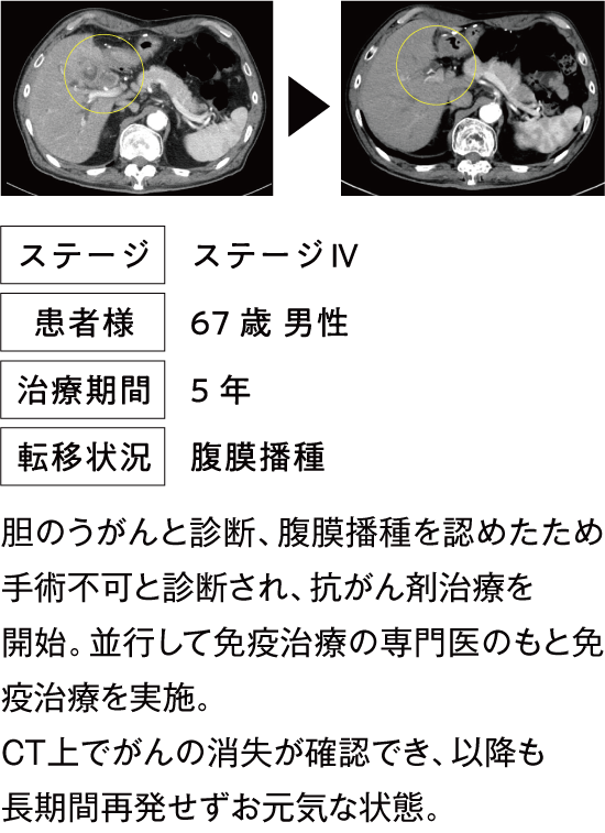 治療例1
