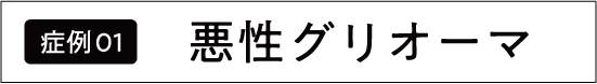 脳腫瘍