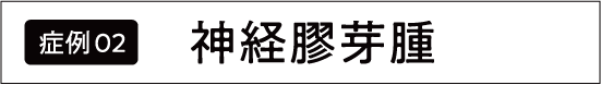 脳腫瘍