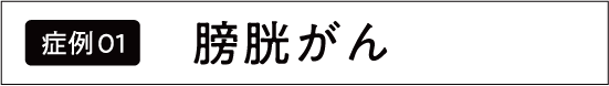 膀胱がん