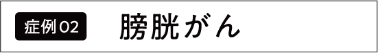 膀胱がん