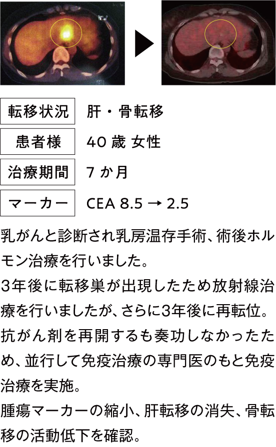 治療例1